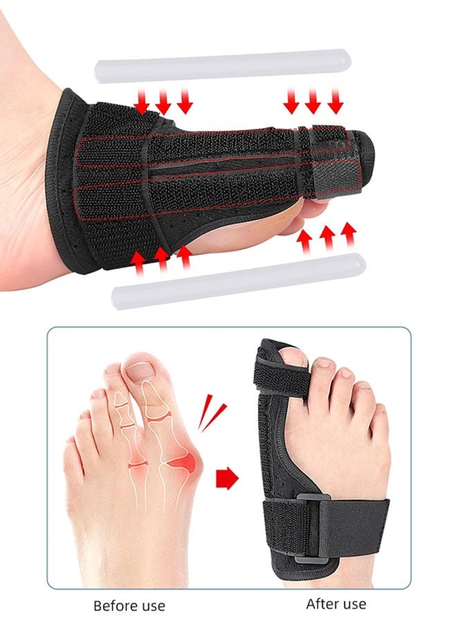 الورم مصحح كبير اصبع القدم مستقيم المطرقة تو الورم لتخفيف الآلام أروح مصحح جبيرة ورم منصات الورم تو هدفين اليمين + اليسار - Image 2